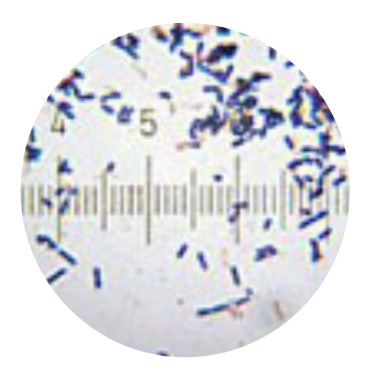 Lactobacillus Acidophilus